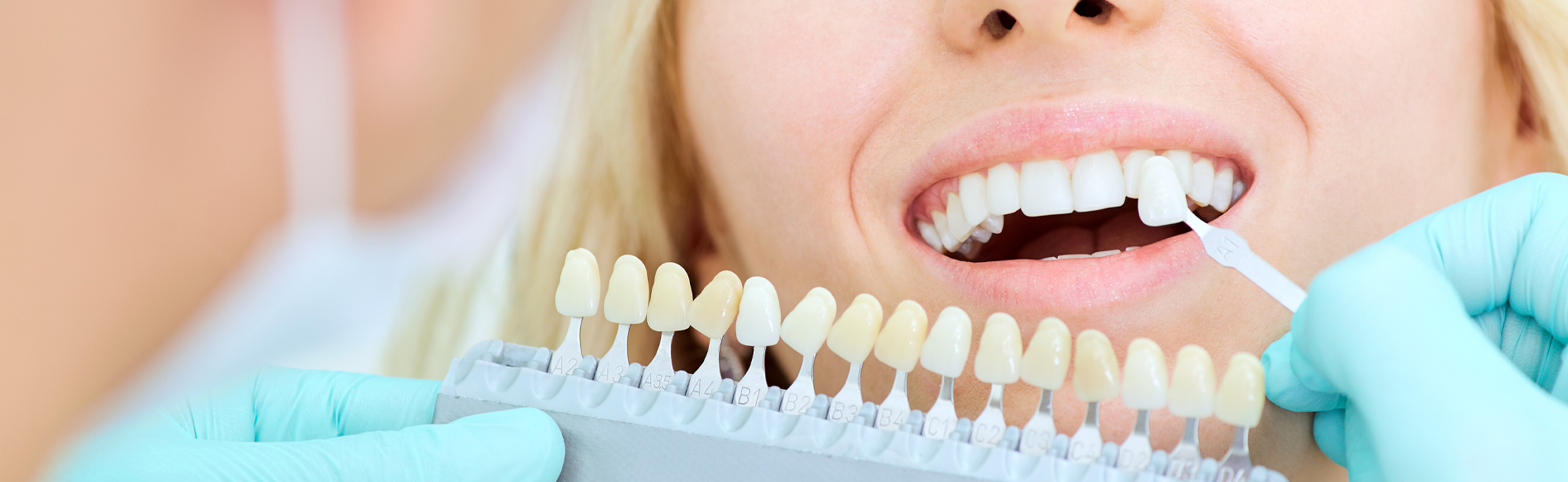 Diş Eti Hastalıklarının Belirtileri ve Önlenmesi Diş Eti Hastalıklarının Belirtileri ve Önlenmesi